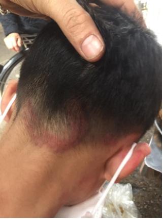 Cháu bé bị bố ruột bạo hành, đánh đập dã man tại Hà Nội khiến dân mạng phẫn nộ-3