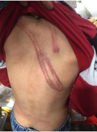 Cháu bé bị bố ruột bạo hành, đánh đập dã man tại Hà Nội khiến dân mạng phẫn nộ-4