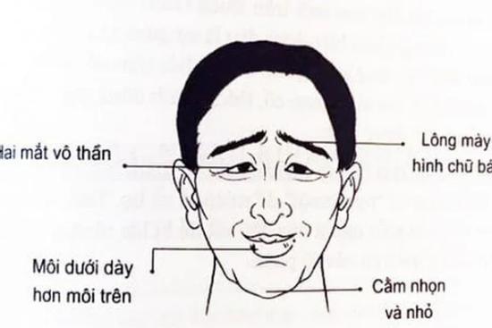 Nam hay nữ nếu sở hữu 5 nét tướng này đều đoản thọ, số phá tài cả đời nghèo khó