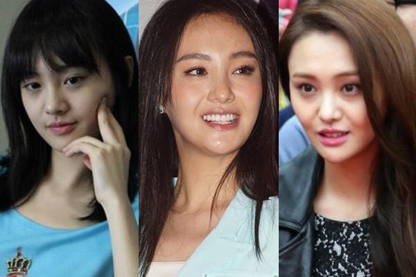 Trịnh Sảng và những mỹ nhân Hoa ngữ thừa nhận thẩm mỹ hỏng-1