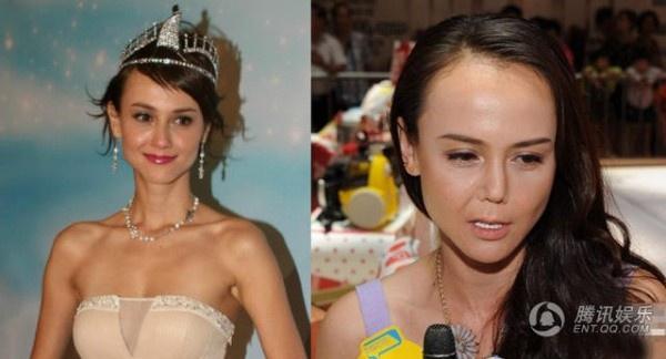 Trịnh Sảng và những mỹ nhân Hoa ngữ thừa nhận thẩm mỹ hỏng-3