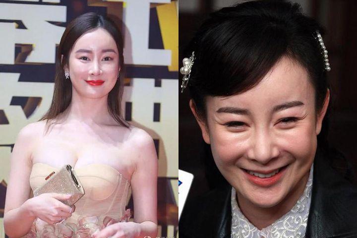 Trịnh Sảng và những mỹ nhân Hoa ngữ thừa nhận thẩm mỹ hỏng-5