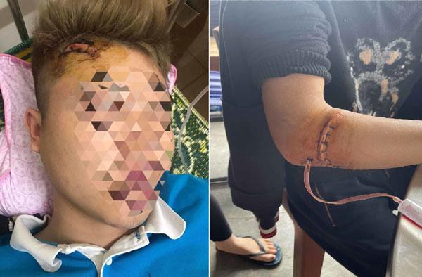 Clip: Mùng 1 đi chúc Tết, hàng chục côn đồ xông vào chém 2 người trọng thương-1