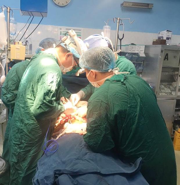 Đùa nghịch làm vỡ cốc, bé gái bị mảnh thủy tinh đâm thủng bụng lộ ruột non-1