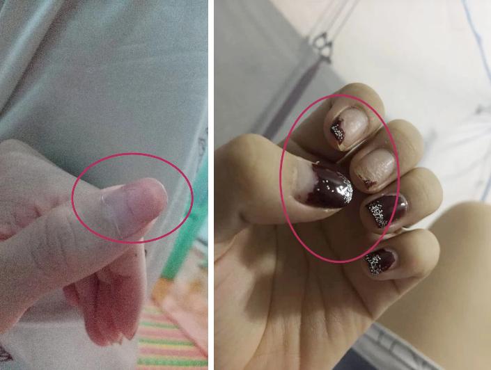 Trước Tết thi nhau khoe nail sang chảnh, ra Tết lại kể khổ vì móng nham nhở như chuột gặm-2