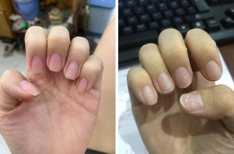 Trước Tết thi nhau khoe nail sang chảnh, ra Tết lại kể khổ vì móng nham nhở như chuột gặm-6