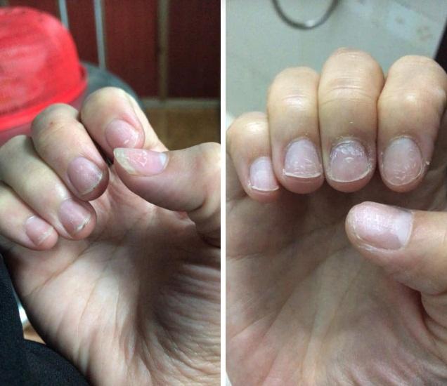 Trước Tết thi nhau khoe nail sang chảnh, ra Tết lại kể khổ vì móng nham nhở như chuột gặm-7