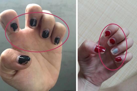 Trước Tết thi nhau khoe nail sang chảnh, ra Tết lại kể 'khổ' vì móng nham nhở như chuột gặm