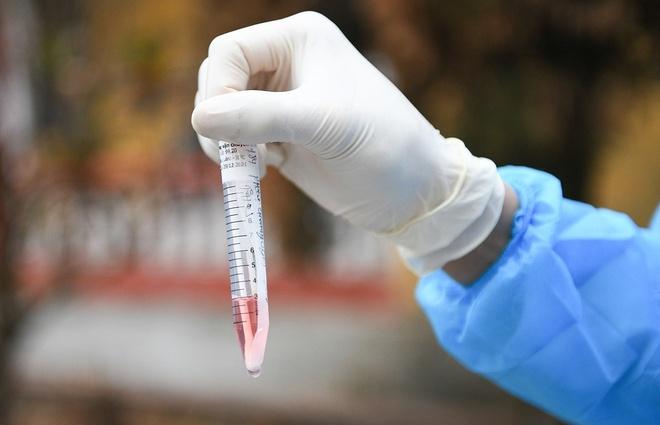 Nhiều F0, F1 ở Hải Dương không tự giác khai báo y tế-1