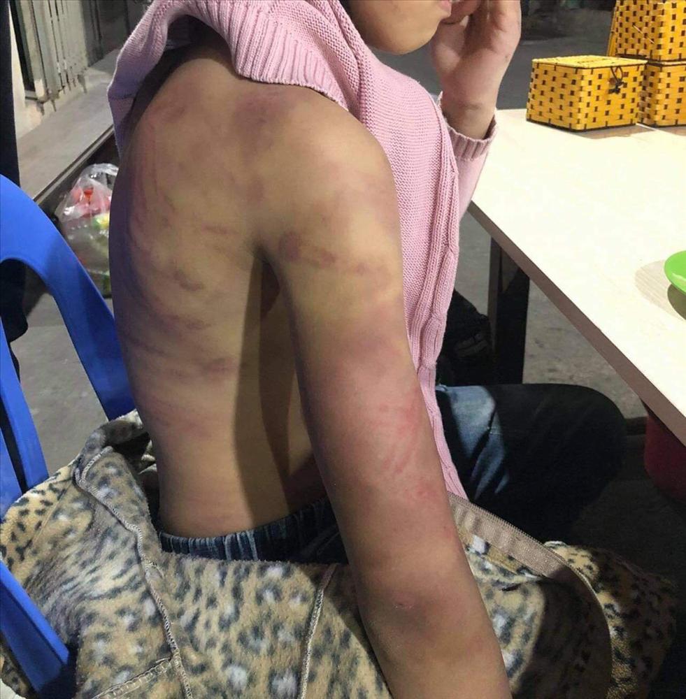 Bé gái 12 tuổi bị nhân tình của mẹ xâm hại: Con ước không phải về ngôi nhà đó-3