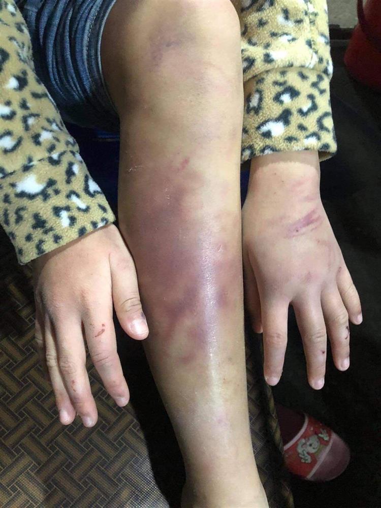 Clip: Mẹ đẻ dùng dây điện quật nát thịt con gái, để người tình xâm hại bé nhiều lần-2