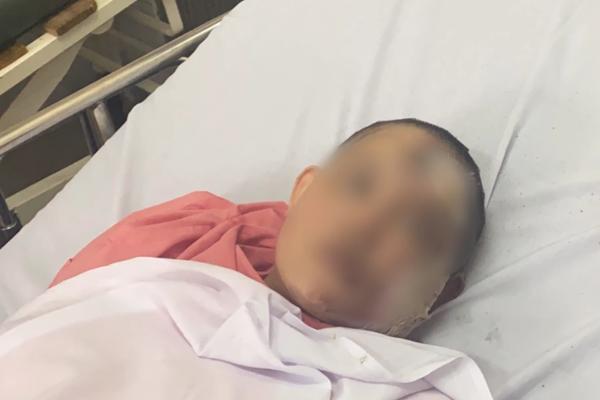 Uống rượu say, chồng vũ phu tẩm xăng thiêu sống vợ-2