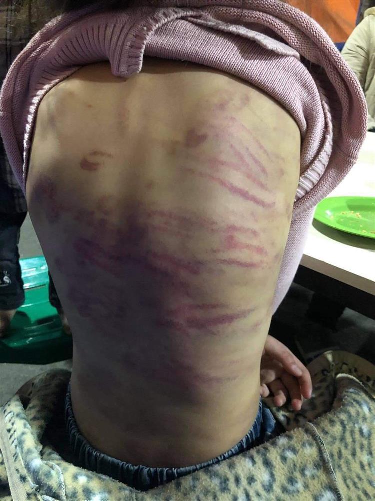 Xót xa bố đẻ bé gái 12 tuổi nghi bị mẹ và người tình bạo hành dã man ở Hà Nội-1