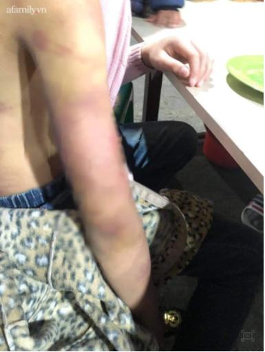 Xót xa bố đẻ bé gái 12 tuổi nghi bị mẹ và người tình bạo hành dã man ở Hà Nội-3