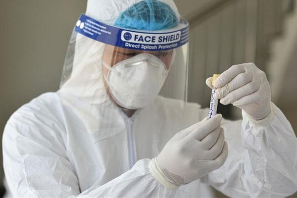 Lý do Việt Nam xét nghiệm Covid-19 rộng trong cộng đồng-4