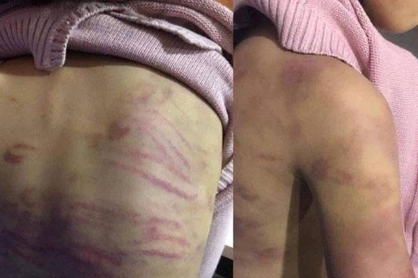 Vụ bé gái 12 tuổi nghi bị bạo hành, xâm hại tình dục ở Hà Nội: Người mẹ nghiện ma tuý-2