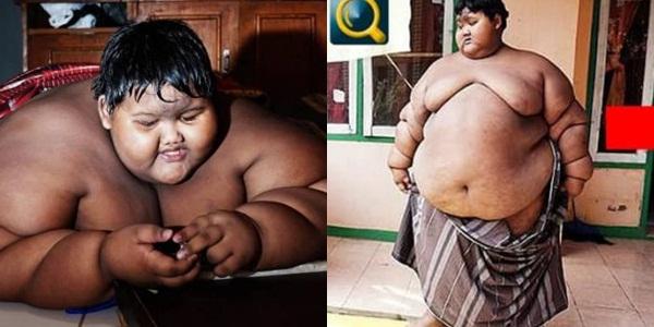 Bất ngờ ngoại hình hiện tại của cậu bé 11 tuổi nặng 382 kg-1