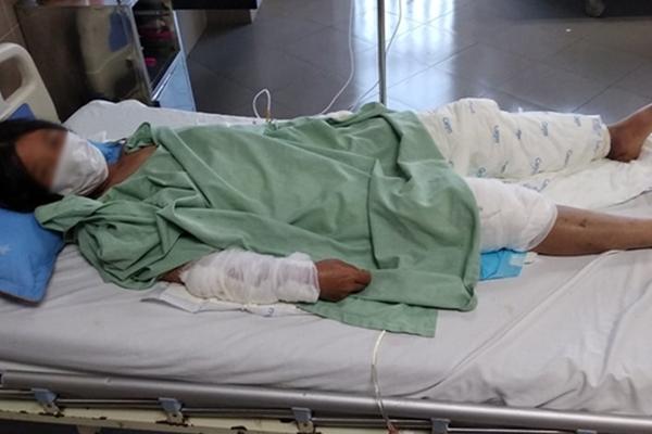 Mách cha chuyện mẹ cặp bồ, cậu bé 8 tuổi bị tẩm xăng thiêu sống-2