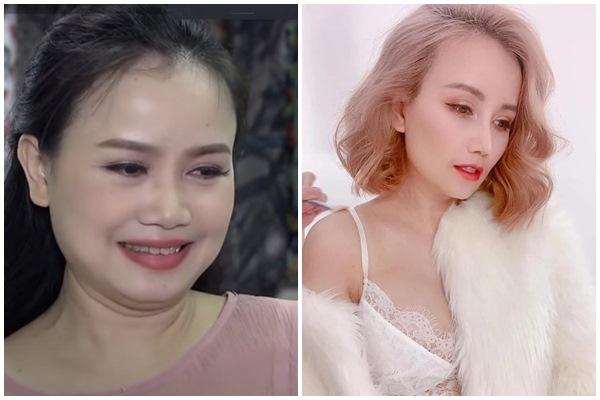 Hãi hùng pha nâng ngực méo mó, hỏng nặng của cô gái-5