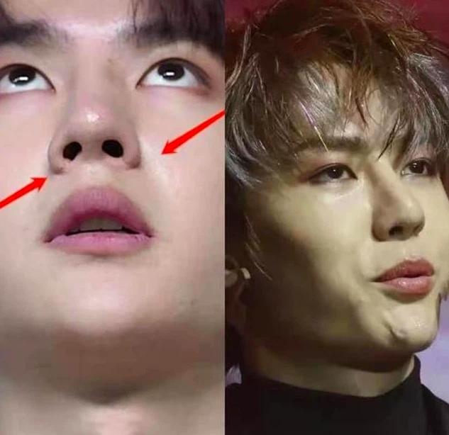 Vương Nhất Bác lộ bằng chứng phẫu thuật thẩm mỹ, nhan sắc hồi chưa dao kéo khác xa hiện tại?-2