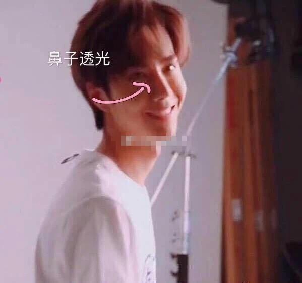 Vương Nhất Bác lộ bằng chứng phẫu thuật thẩm mỹ, nhan sắc hồi chưa dao kéo khác xa hiện tại?-3