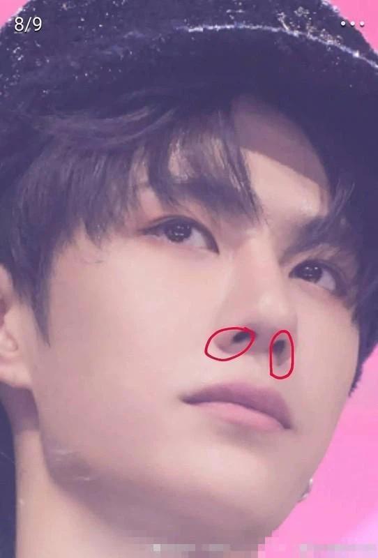 Vương Nhất Bác lộ bằng chứng phẫu thuật thẩm mỹ, nhan sắc hồi chưa dao kéo khác xa hiện tại?-4