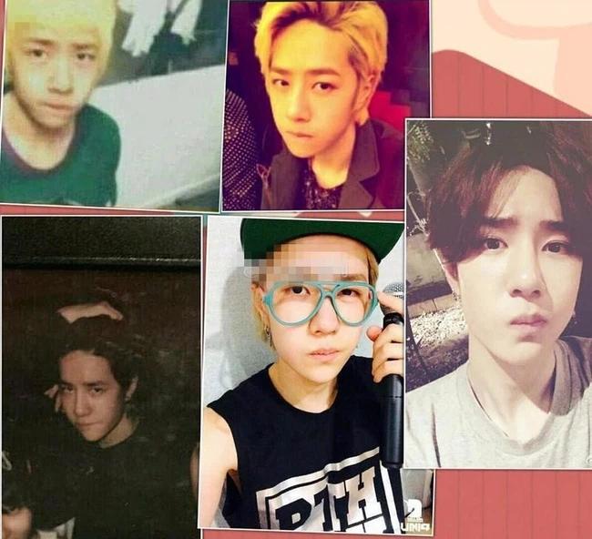 Vương Nhất Bác lộ bằng chứng phẫu thuật thẩm mỹ, nhan sắc hồi chưa dao kéo khác xa hiện tại?-6