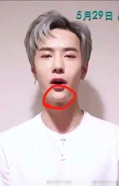 Vương Nhất Bác lộ bằng chứng phẫu thuật thẩm mỹ, nhan sắc hồi chưa dao kéo khác xa hiện tại?-5