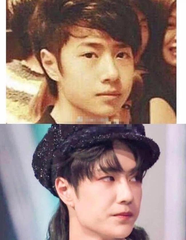 Vương Nhất Bác lộ bằng chứng phẫu thuật thẩm mỹ, nhan sắc hồi chưa dao kéo khác xa hiện tại?-7