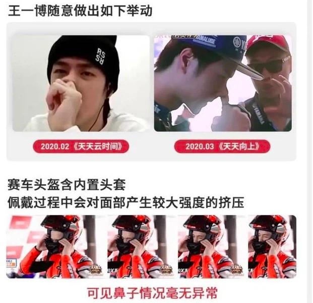 Vương Nhất Bác lộ bằng chứng phẫu thuật thẩm mỹ, nhan sắc hồi chưa dao kéo khác xa hiện tại?-9