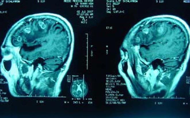 Chụp CT não bé gái rơi từ tầng 13: Bác sĩ cũng không thể tưởng tượng!-1