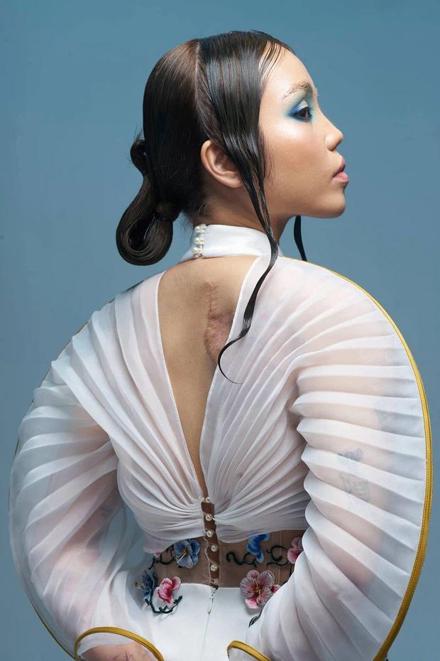 Cô gái Đà Nẵng bị chồng sắp cưới tạt axit khoe ngoại hình mới-3