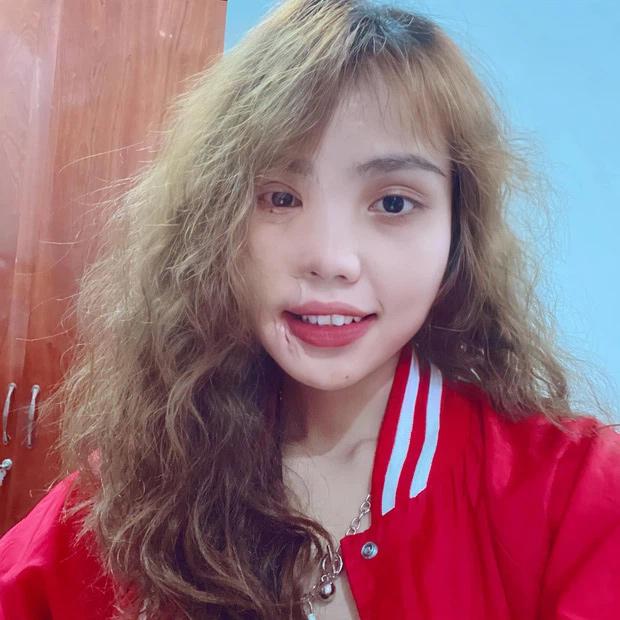 Cô gái Đà Nẵng bị chồng sắp cưới tạt axit khoe ngoại hình mới-2