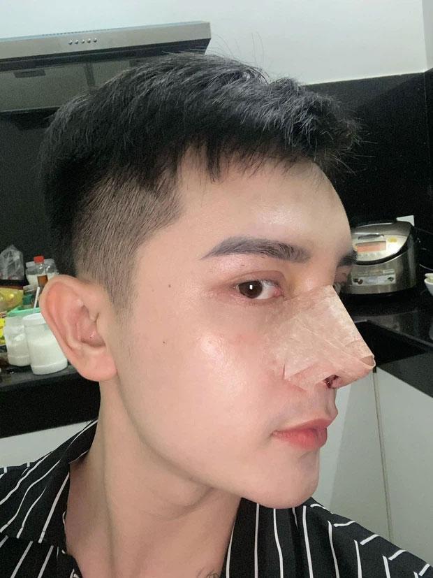 Chàng trai Hưng Yên đập mặt 20 lần đến bố mẹ cũng không nhận ra-2