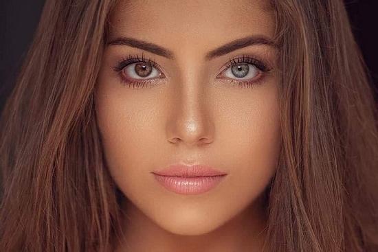 CỰC HIẾM: Hoa hậu có đôi mắt tự nhiên mang 2 màu khác biệt