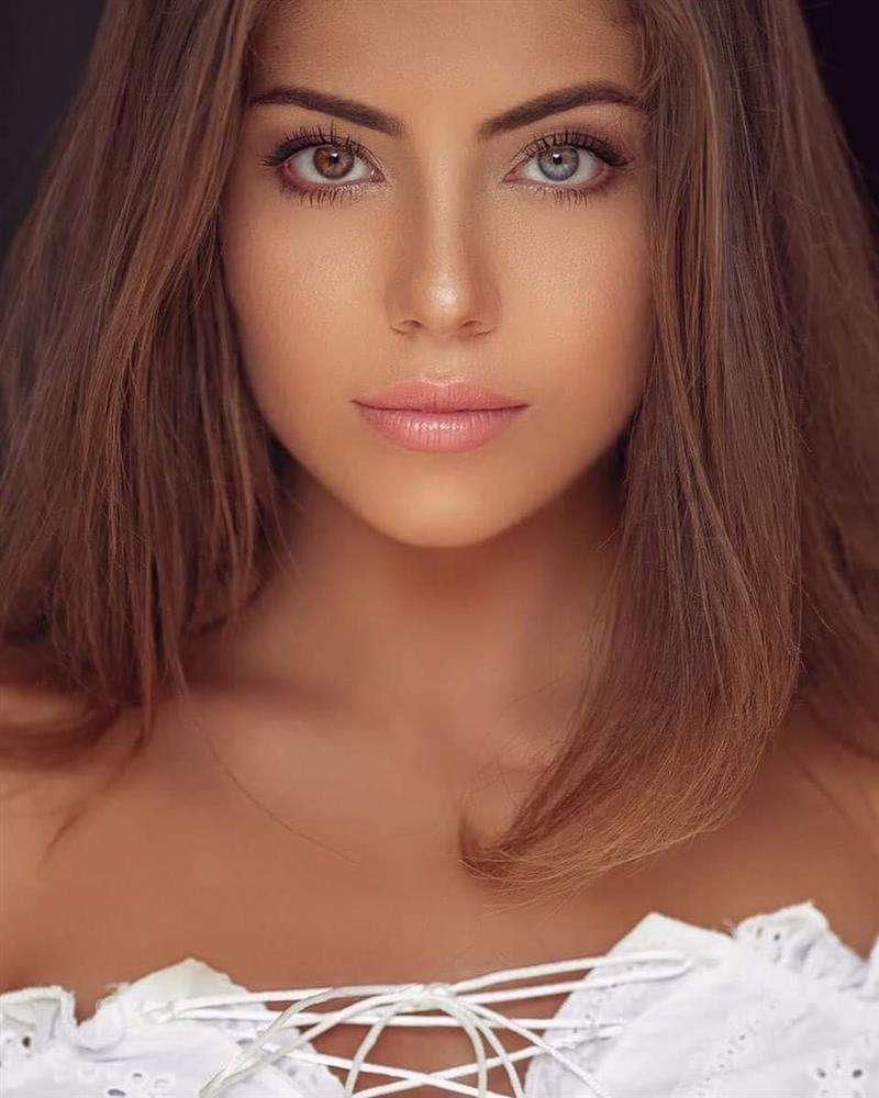 CỰC HIẾM: Hoa hậu có đôi mắt tự nhiên mang 2 màu khác biệt-8