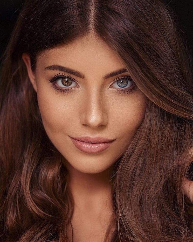 CỰC HIẾM: Hoa hậu có đôi mắt tự nhiên mang 2 màu khác biệt-9