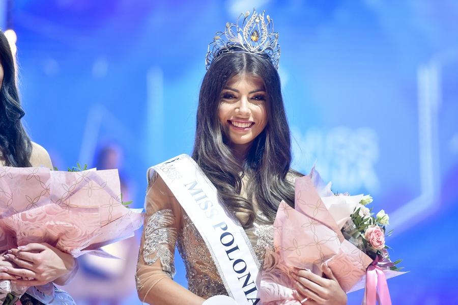 CỰC HIẾM: Hoa hậu có đôi mắt tự nhiên mang 2 màu khác biệt-1