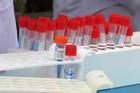 Các mẫu xét nghiệm liên quan 2 ca nhiễm SARS-CoV-2 có kết quả âm tính