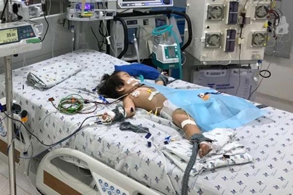 Bé gái đột ngột nguy kịch sau 3 ngày sốt cao-1