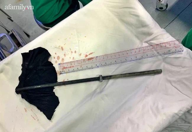 Đang sửa máy lạnh thì trượt chân, nam thanh niên bị thanh sắt dài 30cm đâm xuyên cổ nguy kịch-2
