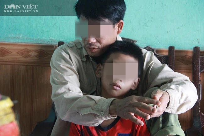 Ông Võ Hoàng Yên nói Mỗi năm tôi chữa cho hơn 4.000 người câm biết nói, thực tế ra sao?-1