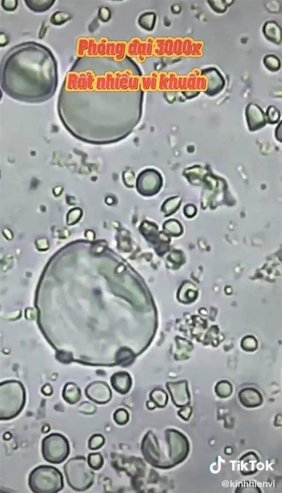 Soi bò khô siêu rẻ bán đầy ngoài chợ dưới kính hiển vi, phát hiện thứ khiến nhiều người khiếp sợ-5