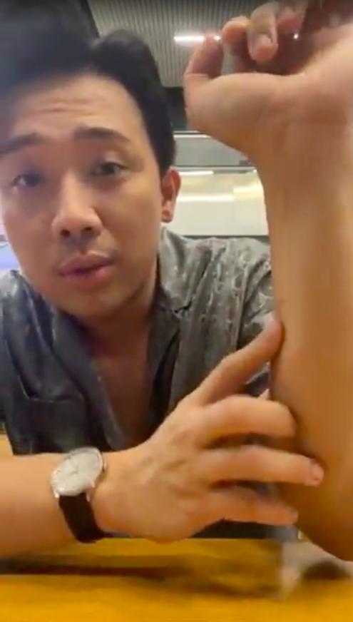 Trấn Thành bị khán giả cào cấu chảy máu khi đến Đà Nẵng-4