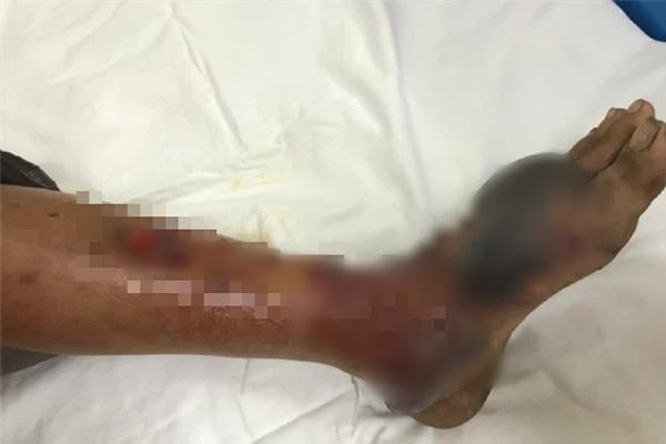 Điều tra vụ ngư dân bị giết hại trên tàu cá rồi vứt thi thể xuống biển-2