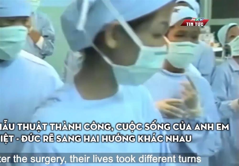 Cặp song sinh dính liền đầu tiên ở Việt Nam sống thế nào sau 33 năm phẫu thuật?-3