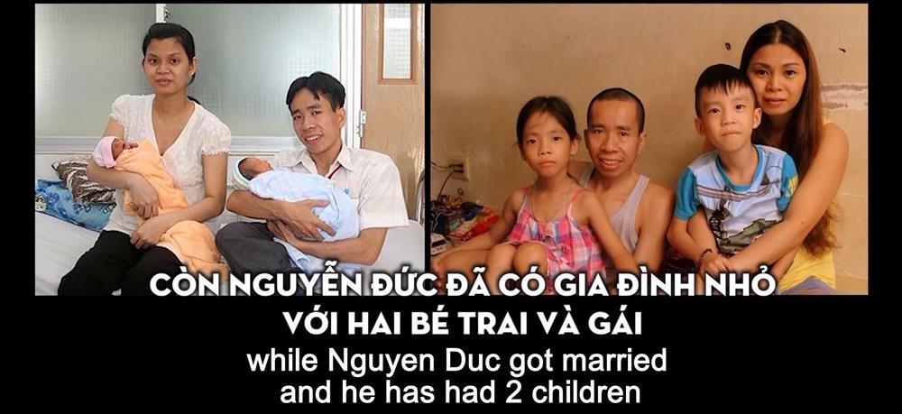 Cặp song sinh dính liền đầu tiên ở Việt Nam sống thế nào sau 33 năm phẫu thuật?-9