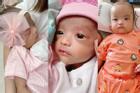 Con gái sinh non 1,9kg của Mạc Văn Khoa nay đã 'có da có thịt'
