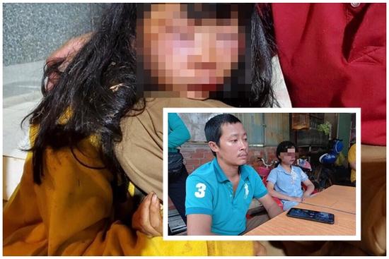 Bé 12 tuổi bị đánh dã man khi đi học về: Đánh ngất rồi kéo lê 60m
