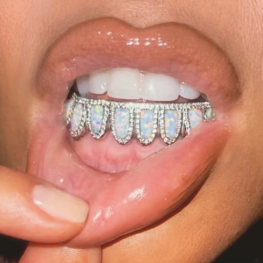 Kim Kardashian khoe răng đính kim cương-1
